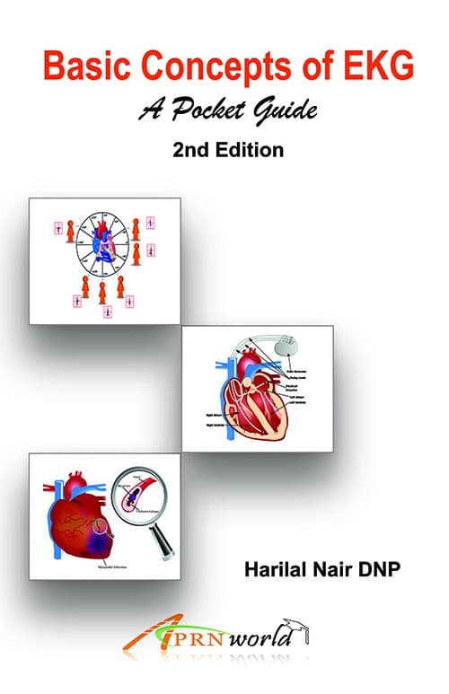 Basic Concepts of EKG — A Pocket Guide